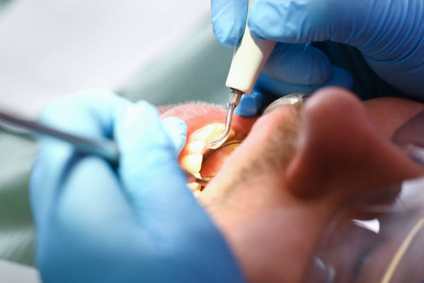 Best Emergency Dental Care for Sports Injuries in Star Valley, AZ